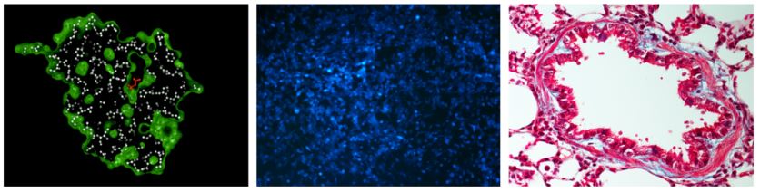 Montage-organiska-foreningar-kroppsegna-proteiner